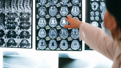 NeuroLink AI: Next-Generation Brain-Computer Interfaces featured image